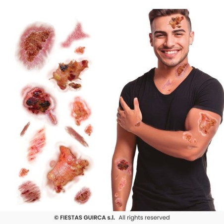 tatuajes-heridas-infectadas-30x13-cm-15918-8434077159187