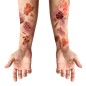 Tatuajes heridas infectadas 30x13 cm