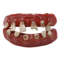 Dientes pirata