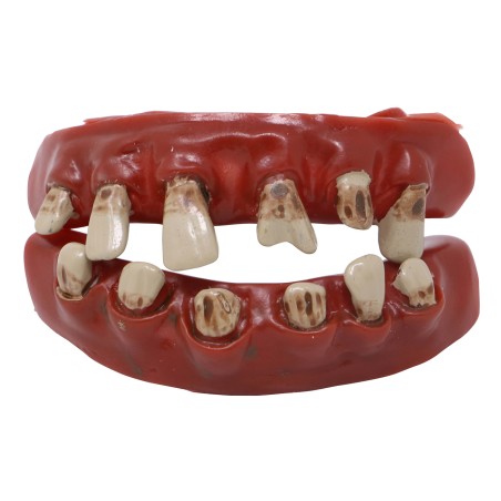 Dientes pirata